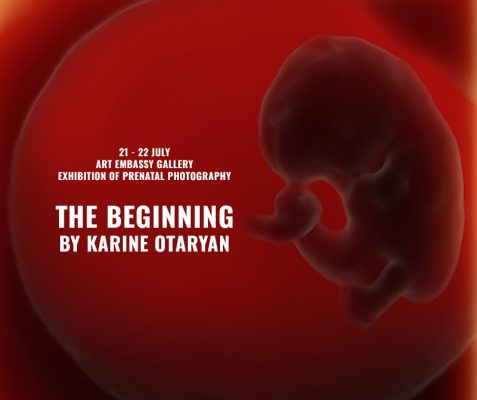 The BeginningExhibition of prenatal photography by Karine Otaryan